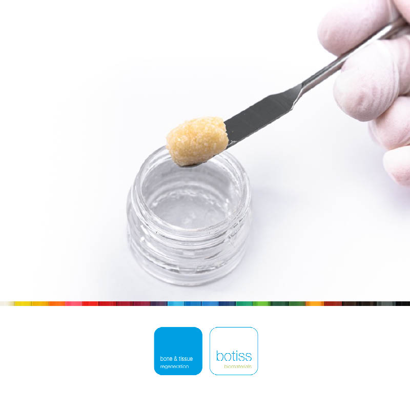 Maxgraft® cortico-cancellous granulater X