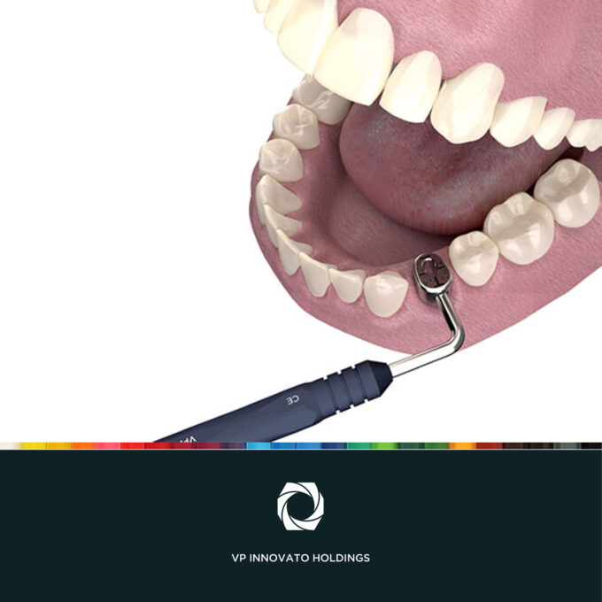Cervico™ Essential Mold & Guide set, 5213006651786 - Image 7
