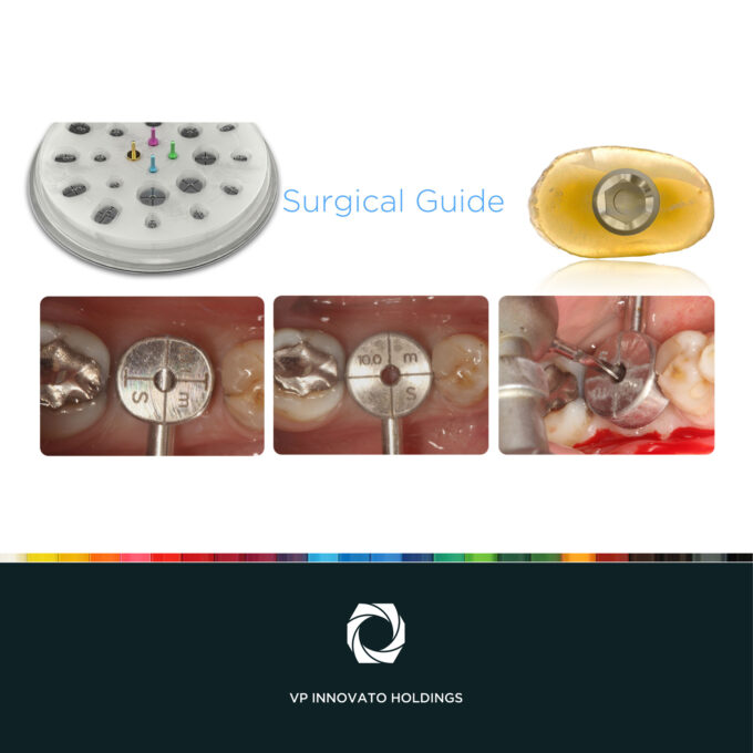 Cervico™ Essential Mold & Guide set, 5213006651786 - Image 12