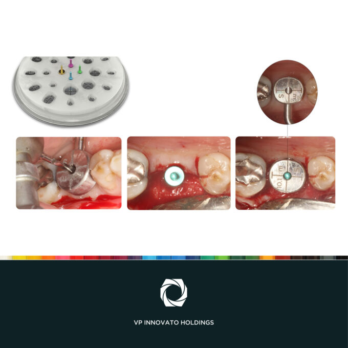 Cervico™ Essential Mold & Guide set, 5213006651786 - Image 11