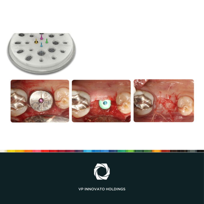 Cervico™ Essential Mold & Guide set, 5213006651786 - Image 13