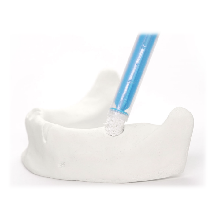 botiss grafter - applicator for bone substitut materials, 1 pcs, 550001 - Image 5