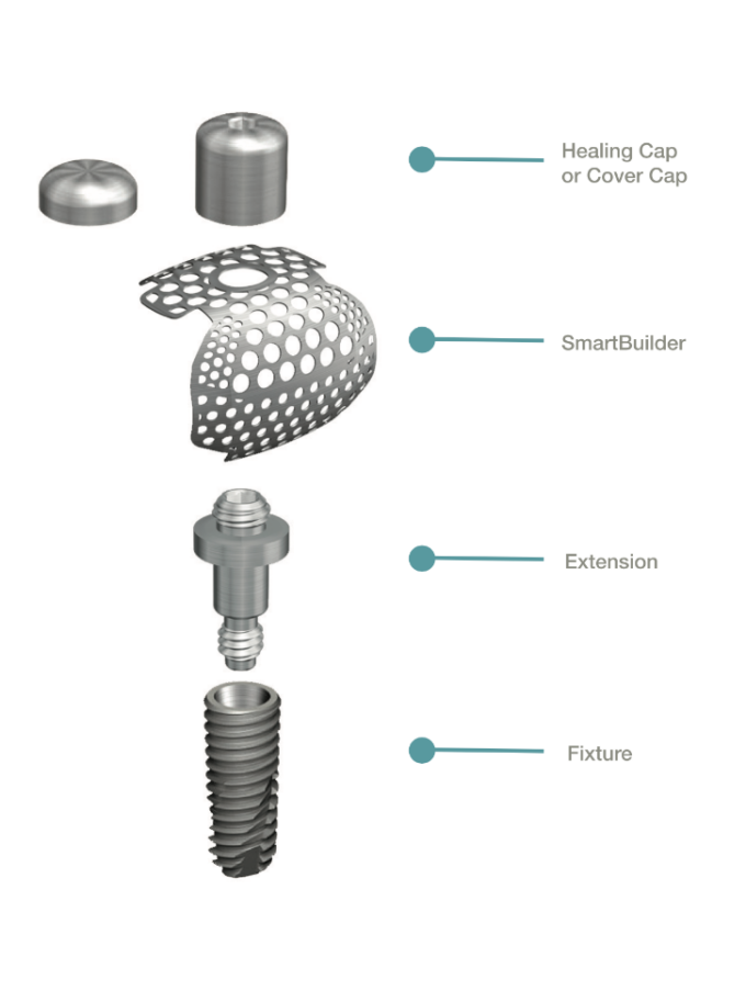 SmartBuilder titaniumsmembran, 1-sidet defekt - Image 7