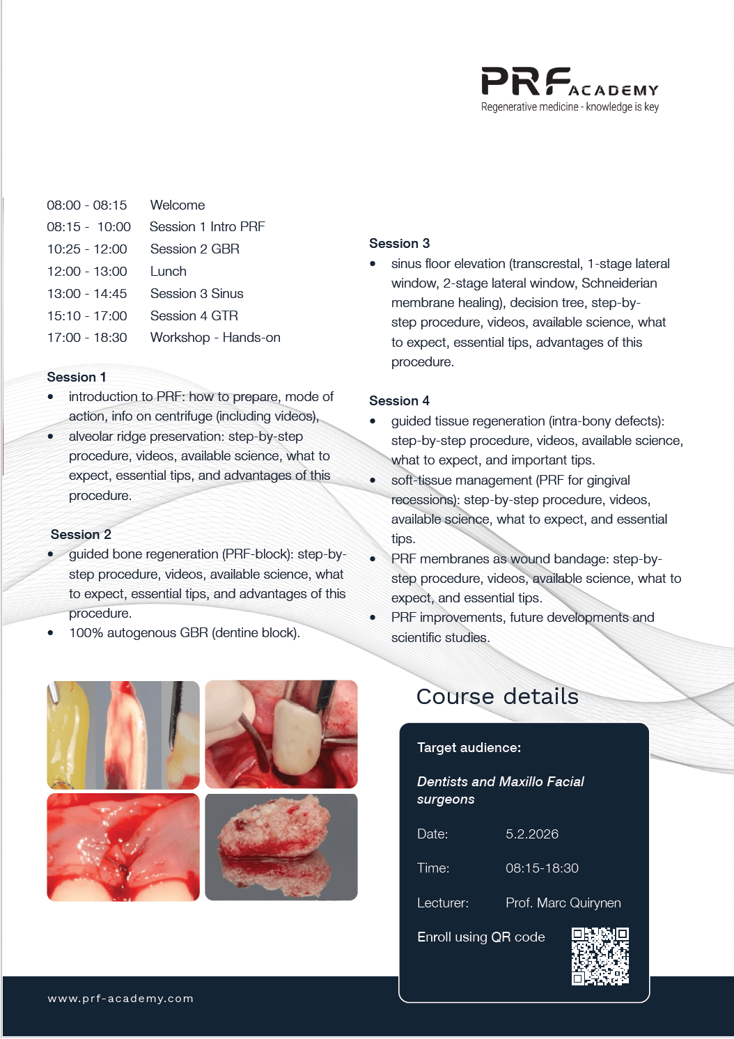 PRF in Dentistry, theory, cases and hands-on, 17th of April 2026 - Image 3